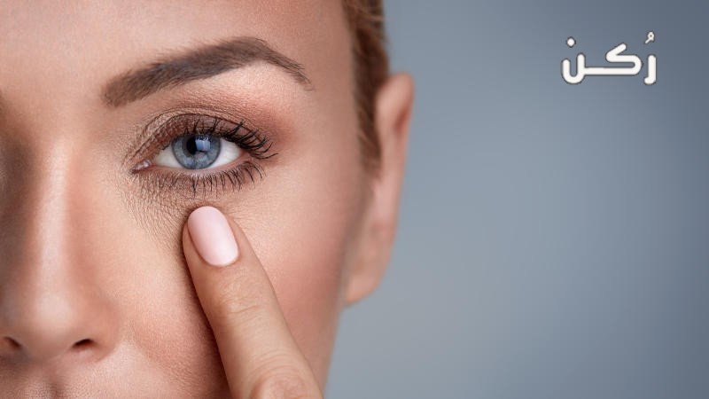 أسباب ظهور الهالات السوداء وعلاجها