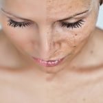 Clearalique Cream