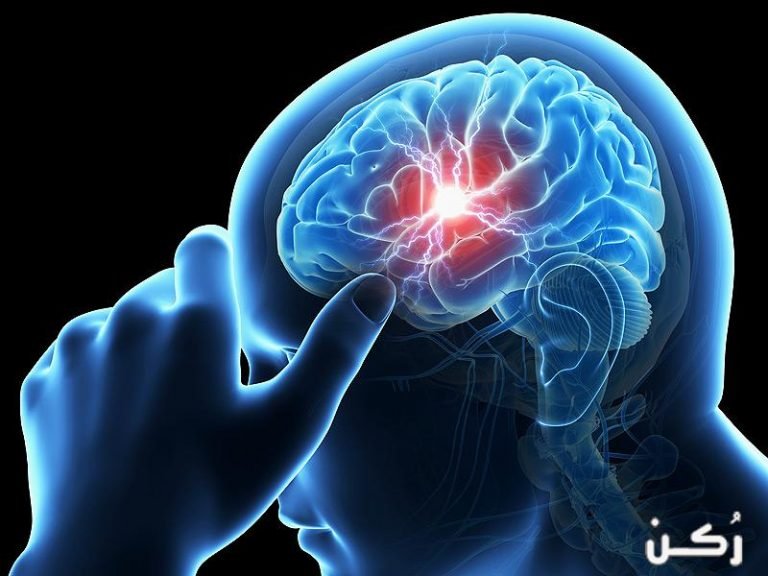 اعراض السكتة الدماغية