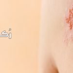 الحزام الناري