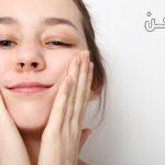 تورم الوجه