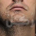 طرق وقاية الذقن من الالتهابات
