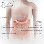 علاج التهاب القولون