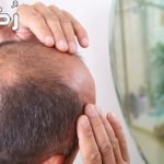 فيناسترايد Finasteride