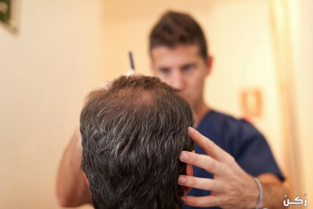 عمليات زراعة الشعر