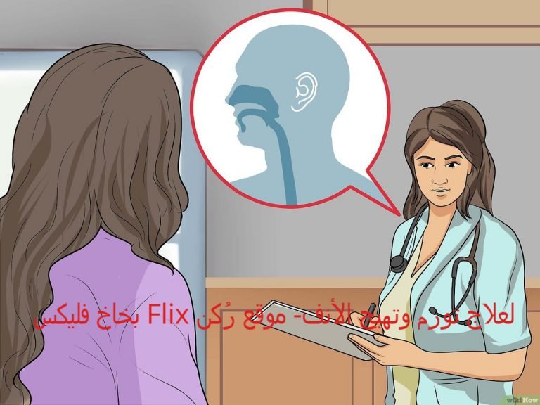بخاخ فليكس Flix