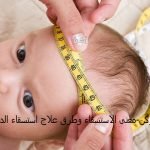 طرق علاج الاستسقاء الدماغي