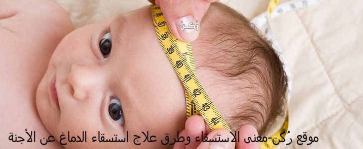 معنى الاستسقاء وطرق علاج الاستسقاء الدماغي عند الأجنة