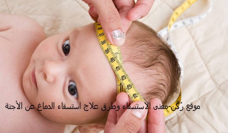 طرق علاج الاستسقاء الدماغي