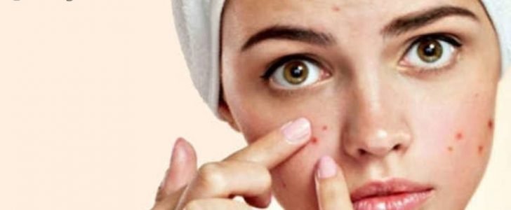 أكرين غسول وصابون وكريم akren cream لعلاج حب الشباب