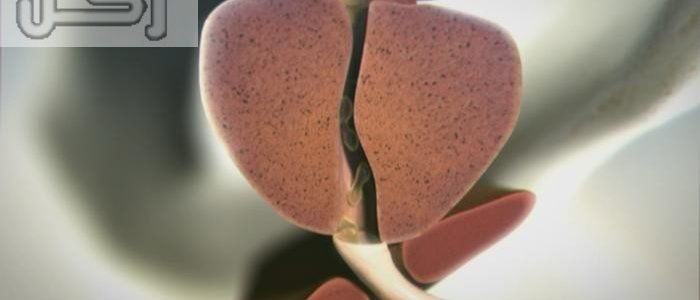 تامسولين بلس Tamsulin لعلاج تضخم البروستات