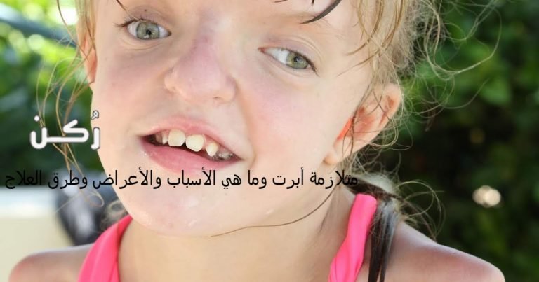متلازمة أبرت