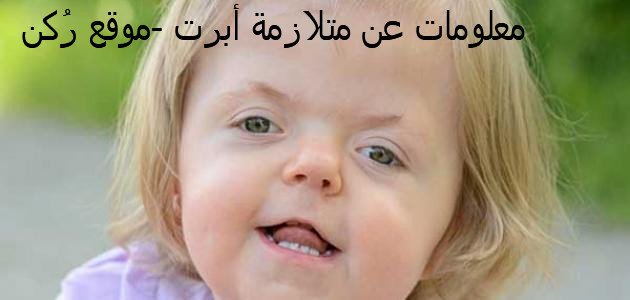 معلومات عن متلازمة أبرت
