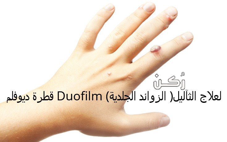 قطرة ديوفلم لعلاج الثآليل