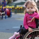 مرض العظم الزجاجي