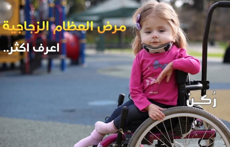 مرض العظم الزجاجي