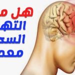 التهاب السحايا