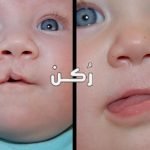 الحنك المشقوق