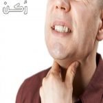 نشرة اقراص روكسيد