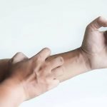 طرق علاج حكة الجسم