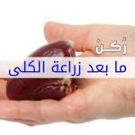 ما بعد زراعة الكلى