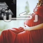 هل ينام الجنين