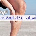 أسباب أرتخاء العضلات