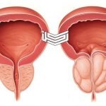 نشرة Xatral أقراص