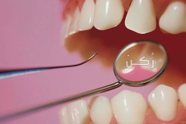 طريقة سحب سن العصب